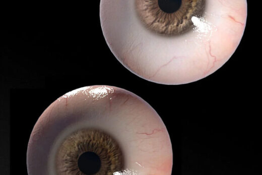 Sy eye brightener genesis 9